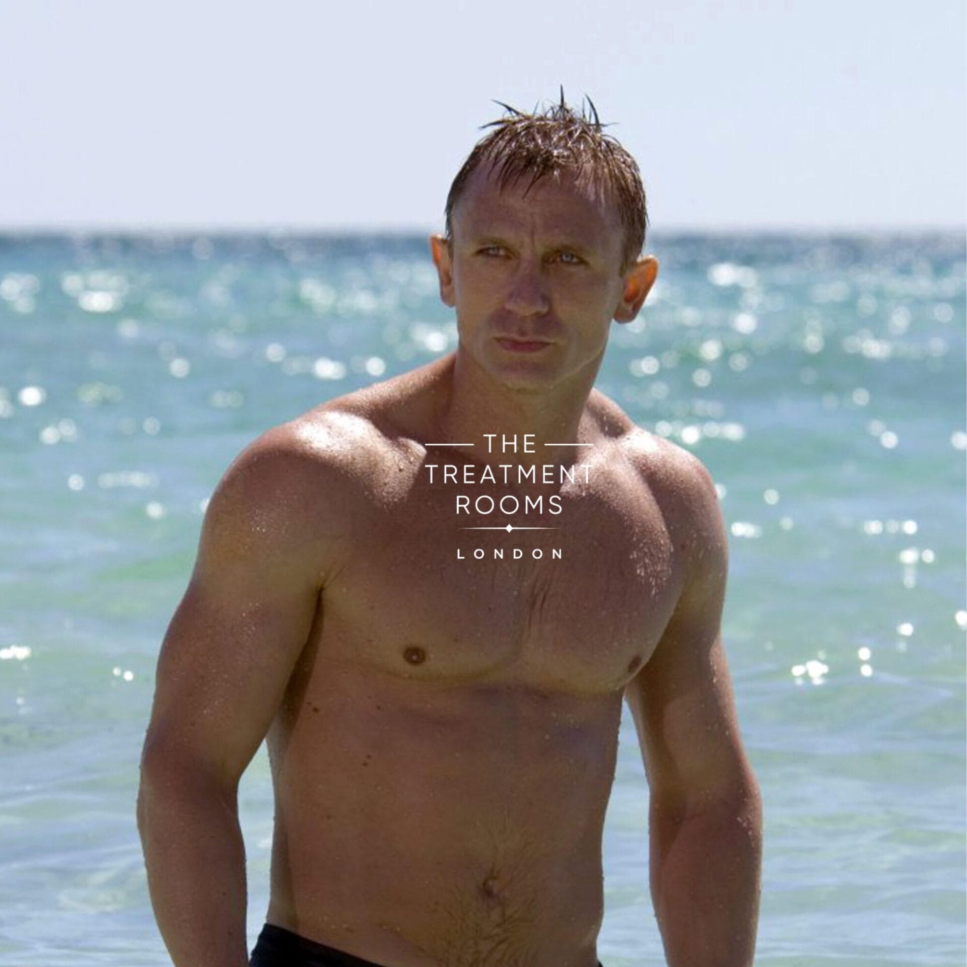 daniel craig hair transplant