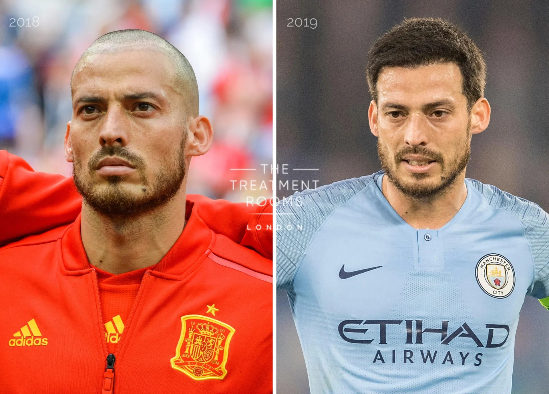 Comparing David Silva's hair in 2018 and 2019