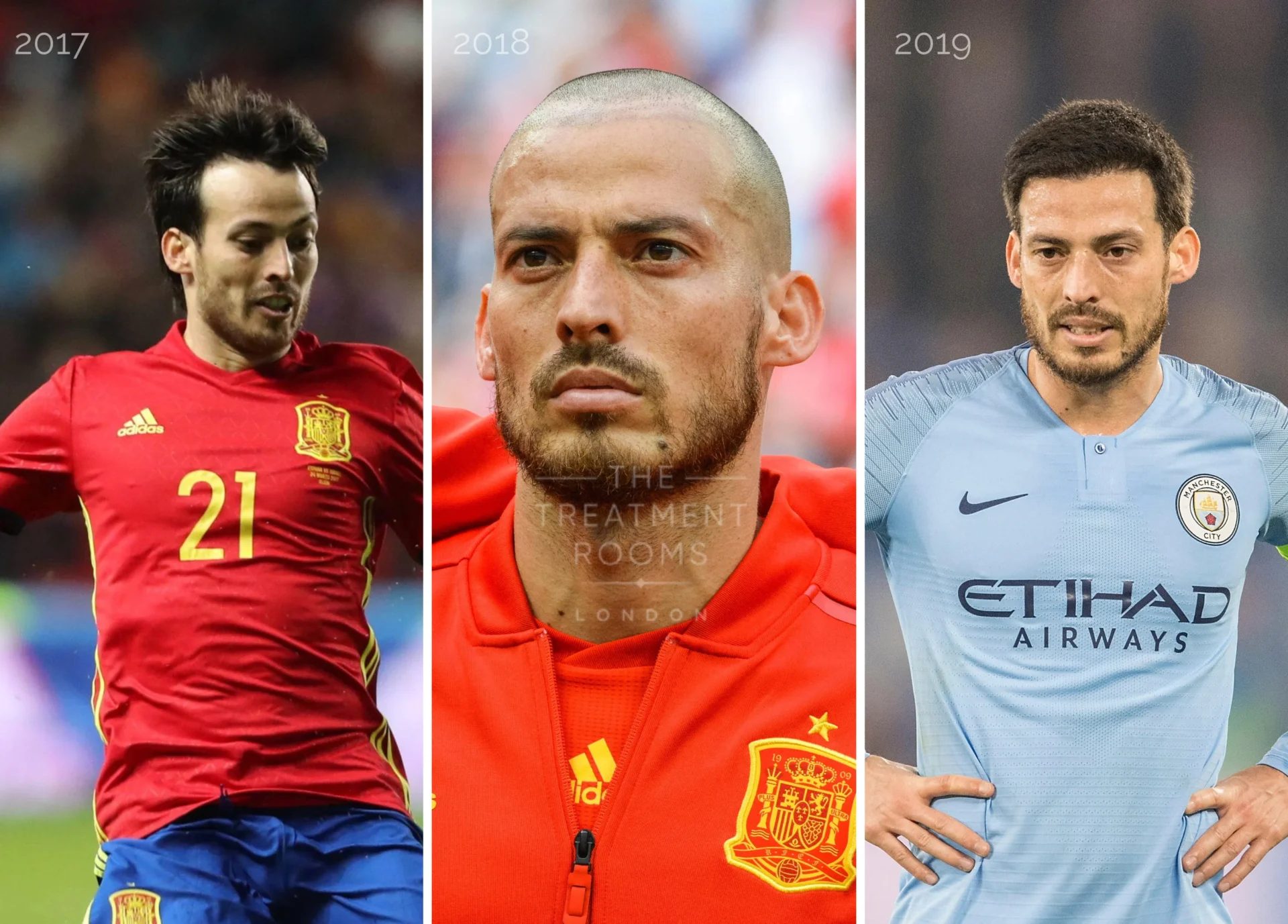 David Silva's hair transformation from 2017 to 2019