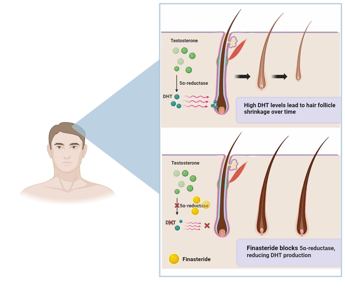Finasteride mechanism of action