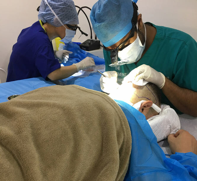 fue hair transplant clinic london