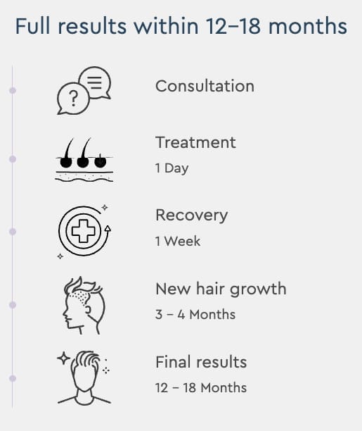 Hair transplant timeline