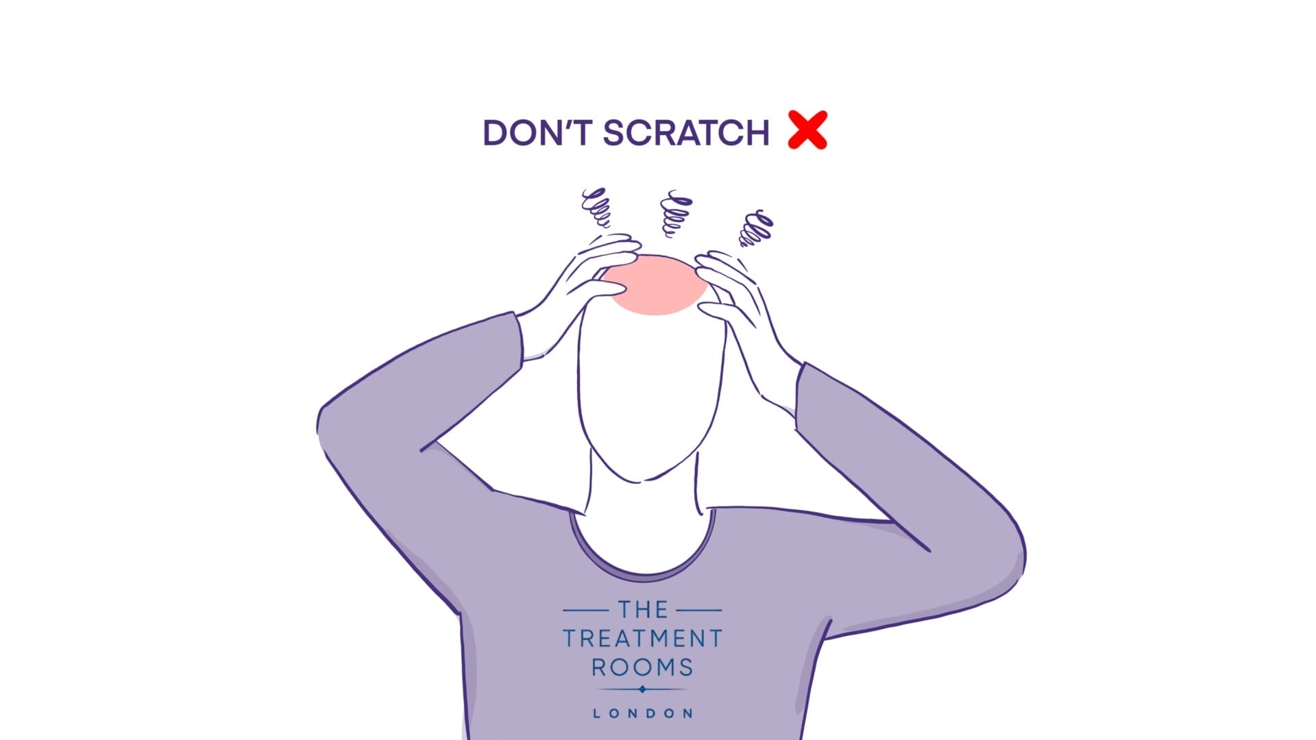 Does Scratching Itches Cause Hair Loss? | Treatment Rooms London