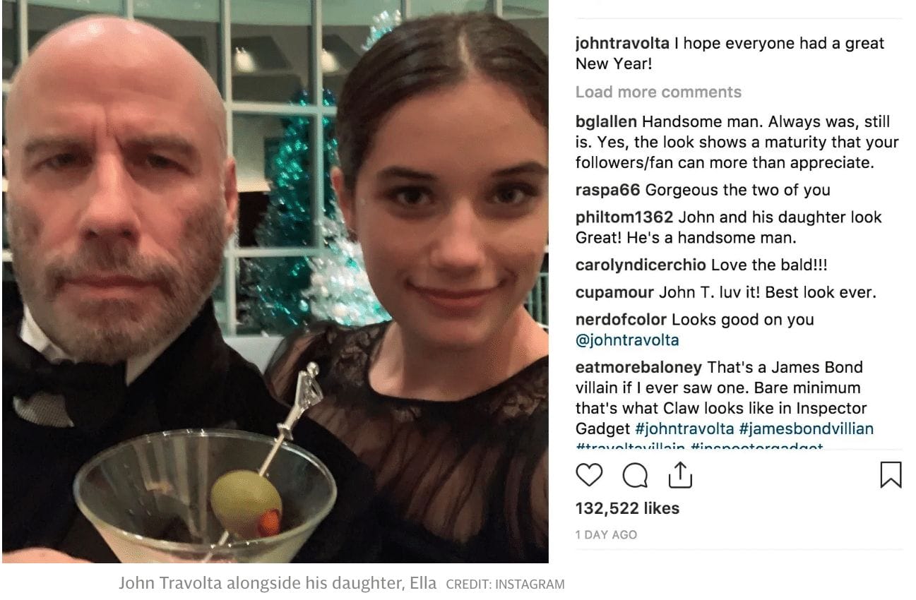 john travolta hair loss