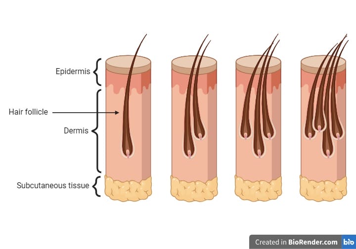 Multiple hair grafts and multiple hair follicles