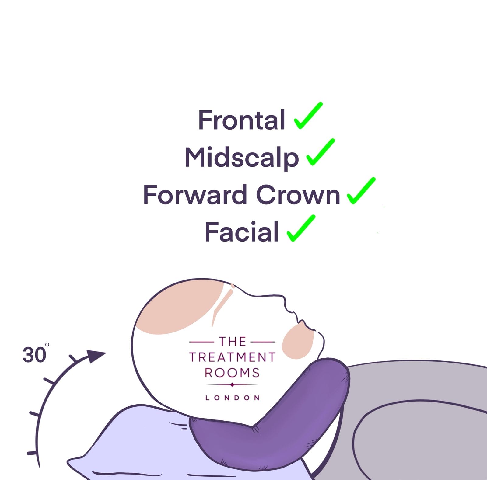 Sleeping after hair transplant