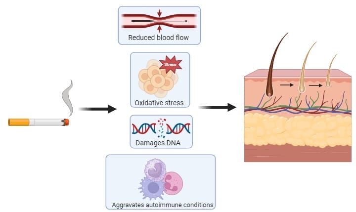 Smoking and hair loss