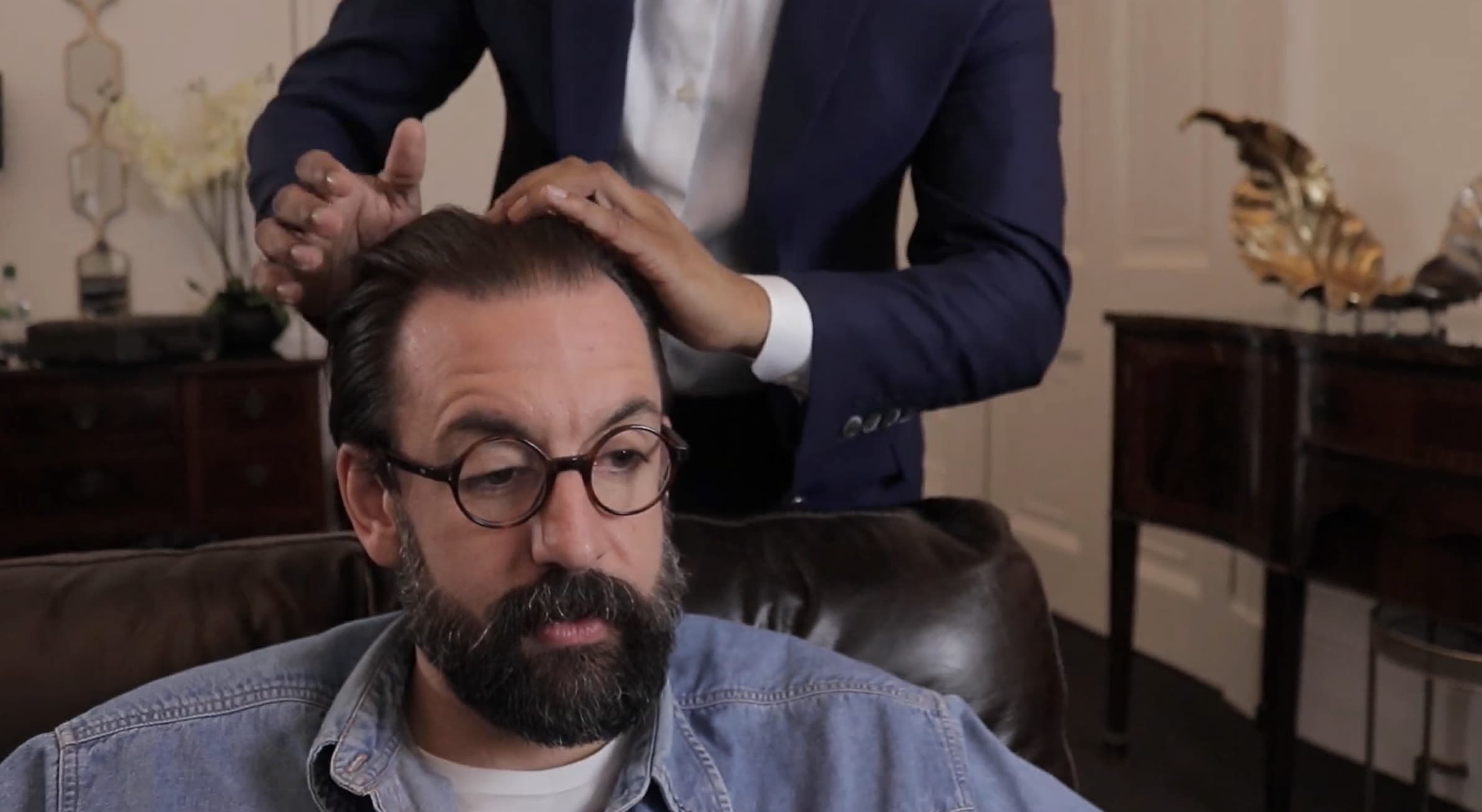 1 month after hair transplant