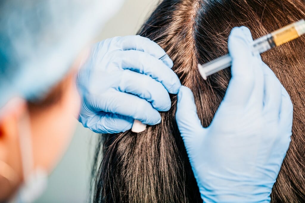Plasmolifting is a unique method of non-surgical face rejuvenation prp injections london