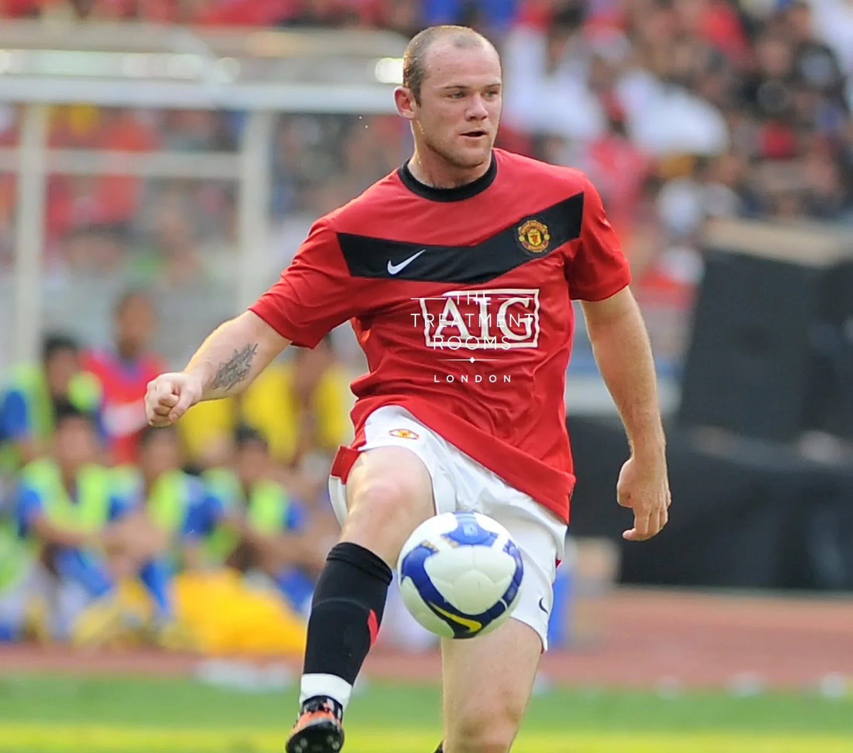 Wayne Rooney with noticeable hair loss in his 20s