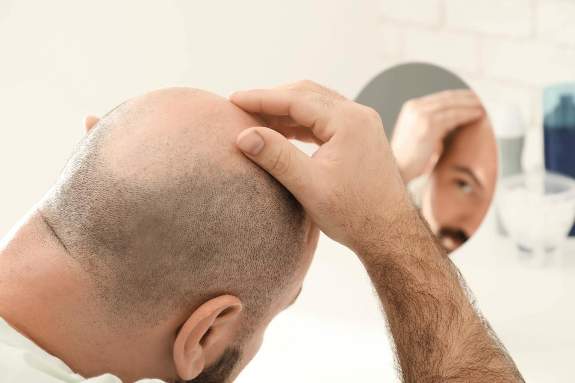 The Complete Guide To Hair Loss Treatment | Treatment Rooms