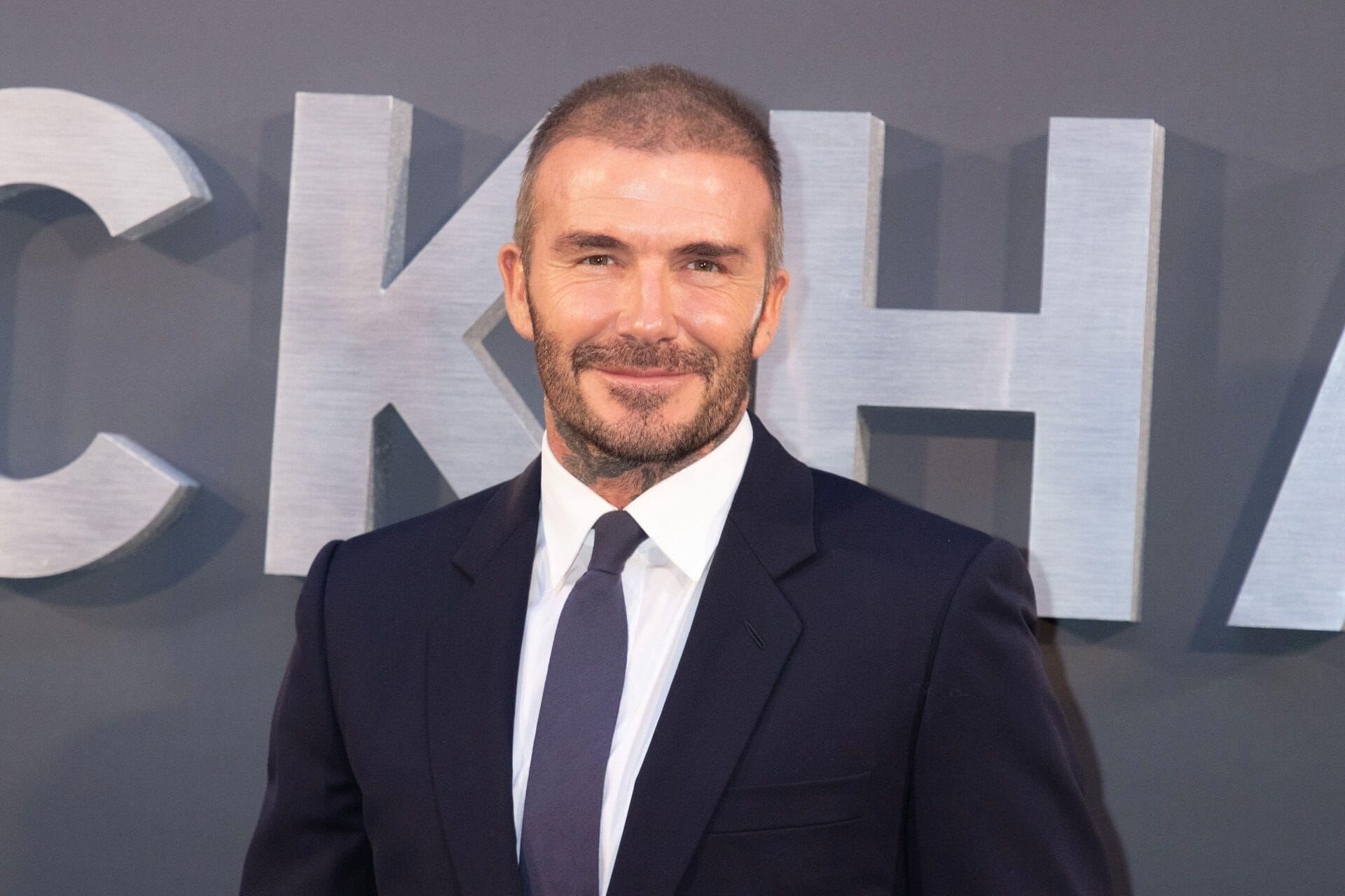 david beckham hair transplant