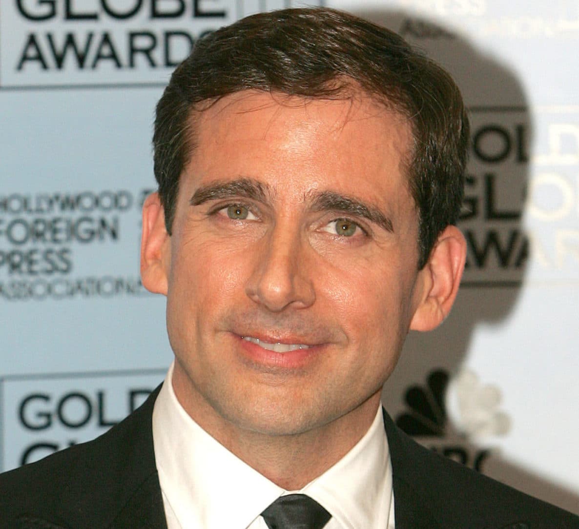 steve carell hair transplant