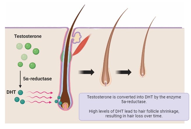 testosterone and hair loss