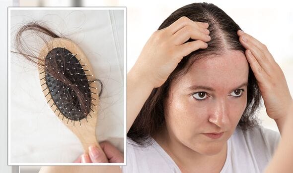 thyroid hormones and female hair loss
